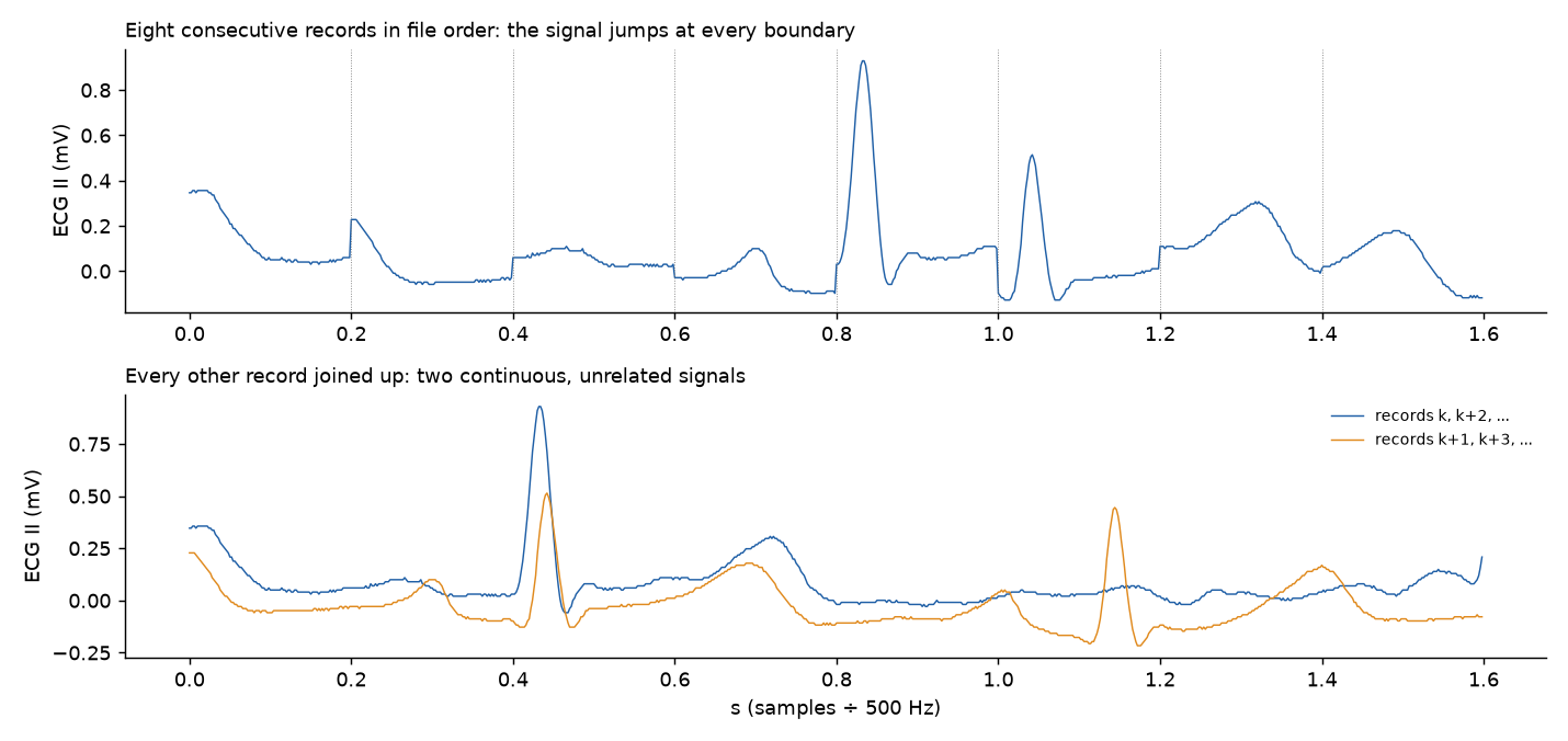 Top, an ECG trace with a step at every 0.2 s boundary. Bottom, two smooth ECG traces, blue and orange, with beats at different times.