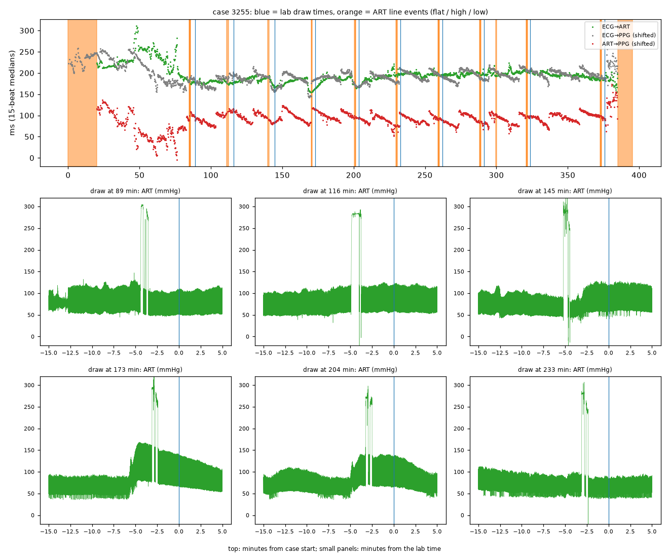 A long timing trace with orange and blue vertical lines above six arterial pressure panels, each with a spike a few minutes before the lab time.